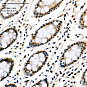 Антитела первичные, поликлональные, Transketolase, 100 мкл