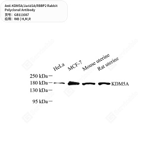 Антитела первичные, поликлональные кролика к KDM5A/Jarid1A/RBBP2 крысы, мыши, человека, 50 мкл