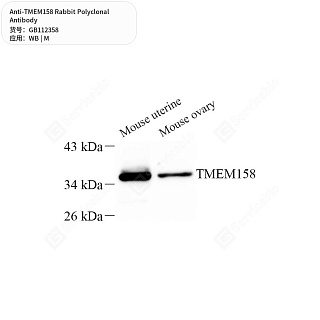 Антитела первичные, поликлональные кролика к TMEM158 мыши, 50 мкл