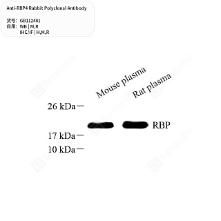 Антитела первичные, поликлональные кролика к RBP4 крысы, мыши, человека, 50 мкл