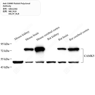 Антитела первичные, поликлональные кролика к CAMKV крысы, мыши, 50 мкл