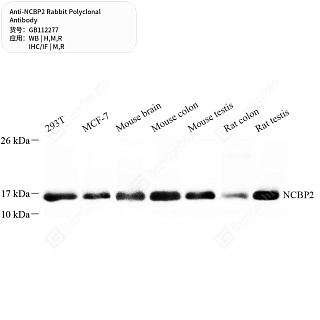 Антитела первичные, поликлональные кролика к NCBP2 крысы, мыши, человека, 50 мкл