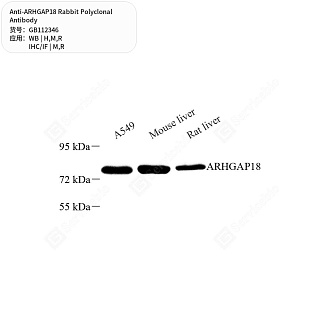Антитела первичные, поликлональные кролика к ARHGAP18 крысы, мыши, человека, 50 мкл