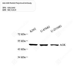 Антитела первичные, поликлональные кролика к AGK крысы, мыши, человека, 50 мкл