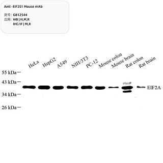 Антитела первичные, моноклональные мыши к EIF2S1 крысы, мыши, человека, 100 мкл