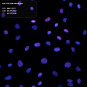 Антитела первичные, поликлональные, CDC20B, 100 мкл