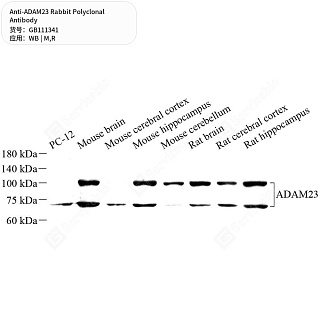 Антитела первичные, поликлональные кролика к ADAM23 крысы, мыши, 50 мкл