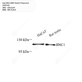Антитела первичные, поликлональные кролика к BNC1/BNC крысы, мыши, человека, 50 мкл