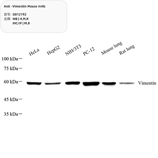 Антитела первичные, моноклональные мыши к Vimentin крысы, мыши, человека, 100 мкл