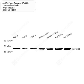 Антитела первичные, поликлональные кролика к TGF beta Receptor II крысы, мыши, человека, 50 мкл