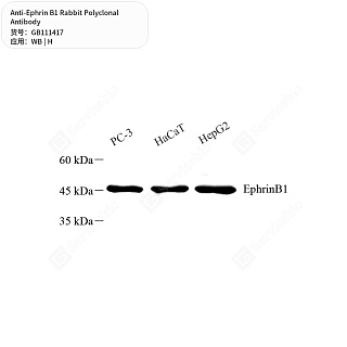 Антитела первичные, поликлональные кролика к Ephrin B1 человека, 50 мкл