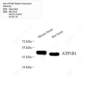 Антитела первичные, поликлональные кролика к ATP1B1 крысы, мыши, человека, 50 мкл