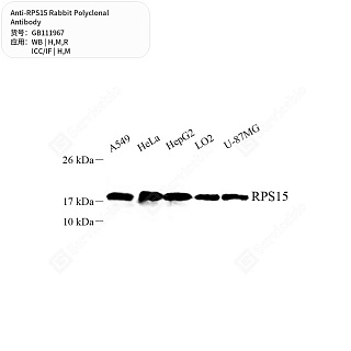 Антитела первичные, поликлональные кролика к RPS15 крысы, мыши, человека, 50 мкл