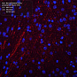 Антитела первичные, моноклональные, Neurofilament heavy polypeptide, 100 мкл
