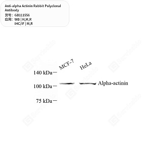 Антитела первичные, поликлональные кролика к alpha Actinin крысы, мыши, человека, 50 мкл