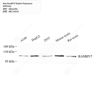 Антитела первичные, поликлональные кролика к RanBP17 крысы, мыши, человека, 50 мкл