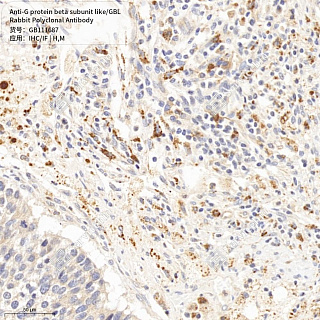 Антитела первичные, поликлональные кролика к G protein beta subunit like/GBL мыши, человека, 50 мкл