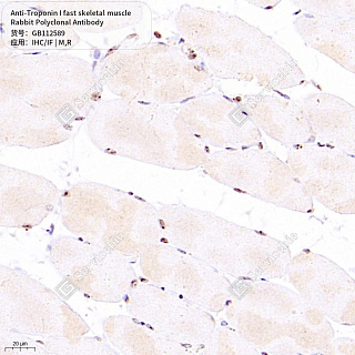 Антитела первичные, поликлональные кролика к Troponin I fast skeletal muscle крысы, мыши, 50 мкл