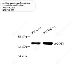 Антитела первичные, поликлональные кролика к Acyl-coenzyme A Thioesterase 4 крысы, мыши, 50 мкл