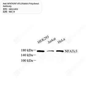 Антитела первичные, поликлональные кролика к NFAT4/NF-ATc3 человека, 50 мкл