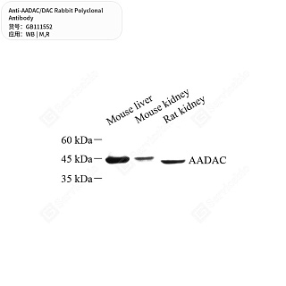 Антитела первичные, поликлональные кролика к AADAC/DAC крысы, мыши, 50 мкл