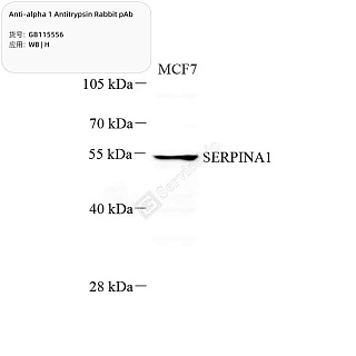 Антитела первичные, поликлональные кролика к alpha 1 Antitrypsin человека, 100 мкл