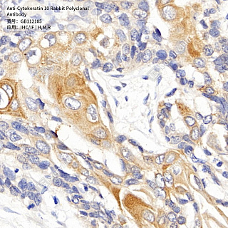 Антитела первичные, поликлональные кролика к Cytokeratin 10 крысы, мыши, человека, 50 мкл