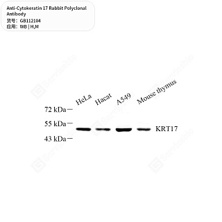 Антитела первичные, поликлональные кролика к Cytokeratin 17 мыши, человека, 50 мкл