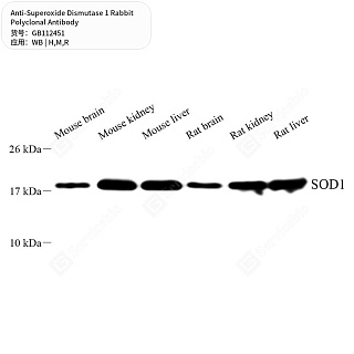 Антитела первичные, поликлональные кролика к Superoxide Dismutase 1 крысы, мыши, человека, 50 мкл