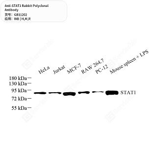 Антитела первичные, поликлональные кролика к STAT1 крысы, мыши, человека, 50 мкл