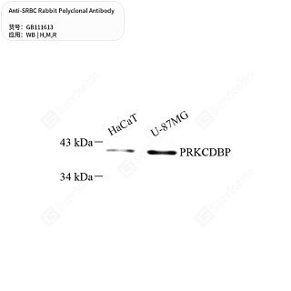 Антитела первичные, поликлональные кролика к SRBC крысы, мыши, человека, 50 мкл