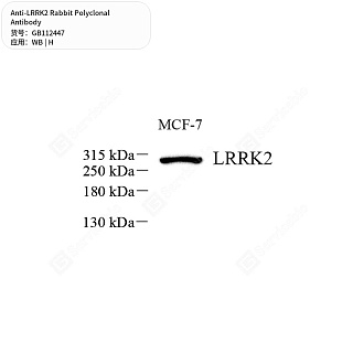 Антитела первичные, поликлональные кролика к LRRK2 человека, 50 мкл