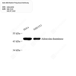 Антитела первичные, поликлональные кролика к ADA крысы, мыши, 50 мкл