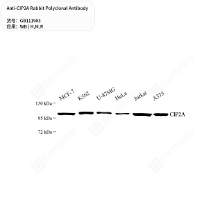 Антитела первичные, поликлональные кролика к CIP2A крысы, мыши, человека, 50 мкл