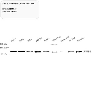 Антитела первичные, поликлональные кролика к 53BP2/ASPP2/BBP крысы, мыши, человека, 100 мкл