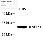 Антитела первичные, поликлональные, RNF151, 100 мкл