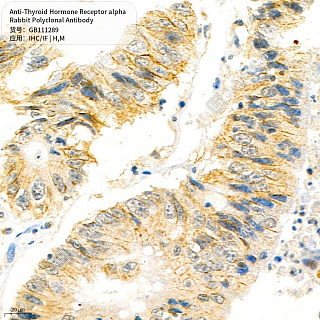 Антитела первичные, поликлональные кролика к Thyroid Hormone Receptor alpha мыши, человека, 50 мкл