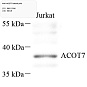 Антитела первичные, поликлональные, ACOT7, 100 мкл