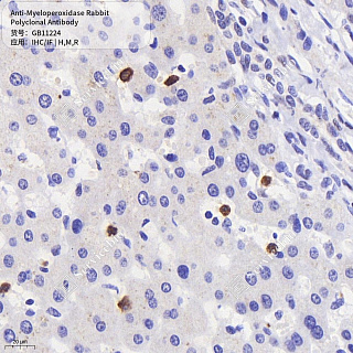 Антитела первичные, поликлональные кролика к Myeloperoxidase крысы, мыши, человека, 50 мкл