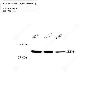 Антитела первичные, поликлональные кролика к CDK4 мыши, человека, 50 мкл