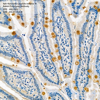 Антитела первичные, поликл. кролика к Natriuretic peptide receptor B крысы, мыши, человека, 50 мкл