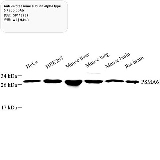 Антитела первичные, поликл. кролика к Proteasome subunit alpha type 6 крысы, мыши, чел., 100 мкл