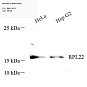 Антитела первичные, поликлональные, RPL22, 100 мкл