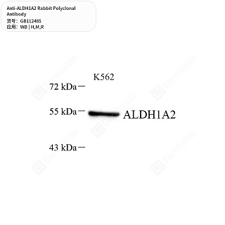 Антитела первичные, поликлональные кролика к ALDH1A2 крысы, мыши, человека, 50 мкл