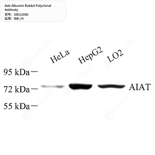 Антитела первичные, поликлональные кролика к Albumin человека, 50 мкл