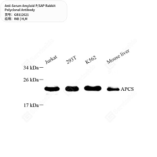 Антитела первичные, поликлональные кролика к Serum Amyloid P/SAP мыши, человека, 50 мкл