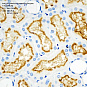 Антитела первичные, поликлональные, Angiotensin Converting Enzyme 1, 100 мкл