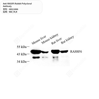 Антитела первичные, поликлональные кролика к RASSF6 крысы, мыши, 50 мкл
