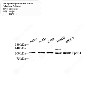 Антитела первичные, поликлональные кролика к Eph receptor B4/HTK человека, 50 мкл