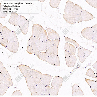 Антитела первичные, поликлональные кролика к Cardiac Troponin C крысы, 50 мкл